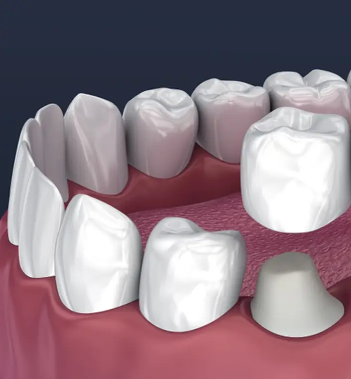 Periodontal Care at Wilson Dentistry