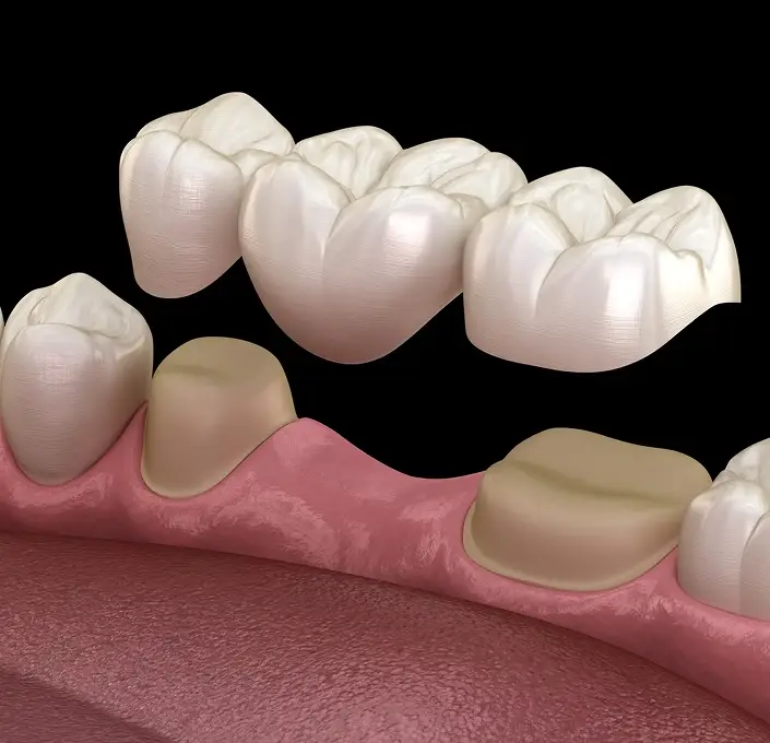 Teeth Cleaning at Wilson Dentistry