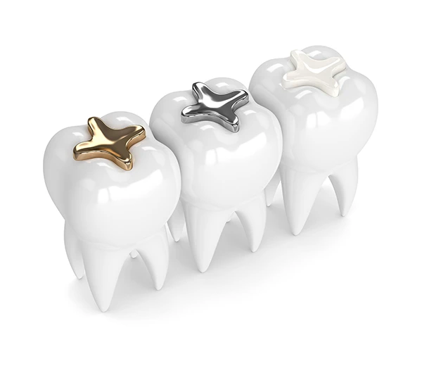 Can I Change Out My Fillings