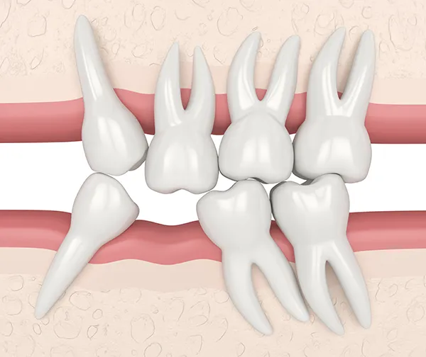 Can Teeth Misalignment Affect The Quality Of Your Life