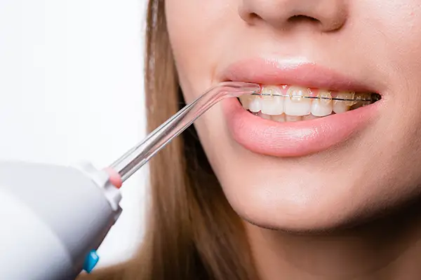 Oral Health Benefits Of Using a Water Flosser
