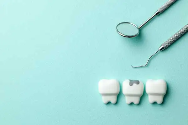 The Different Types of Cavities