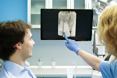 Dental X Ray and their Functions