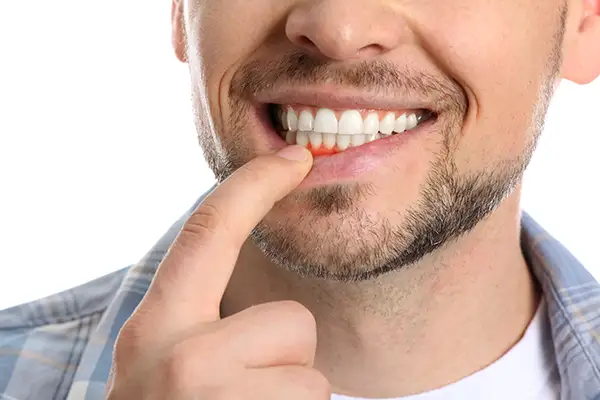 Dangers Associated with Toothbrush Sharing