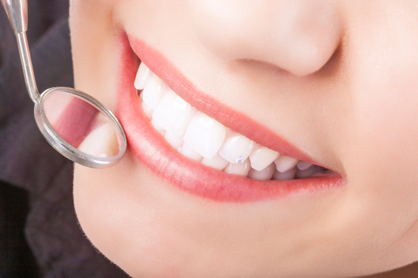 Considering Dental Sealants